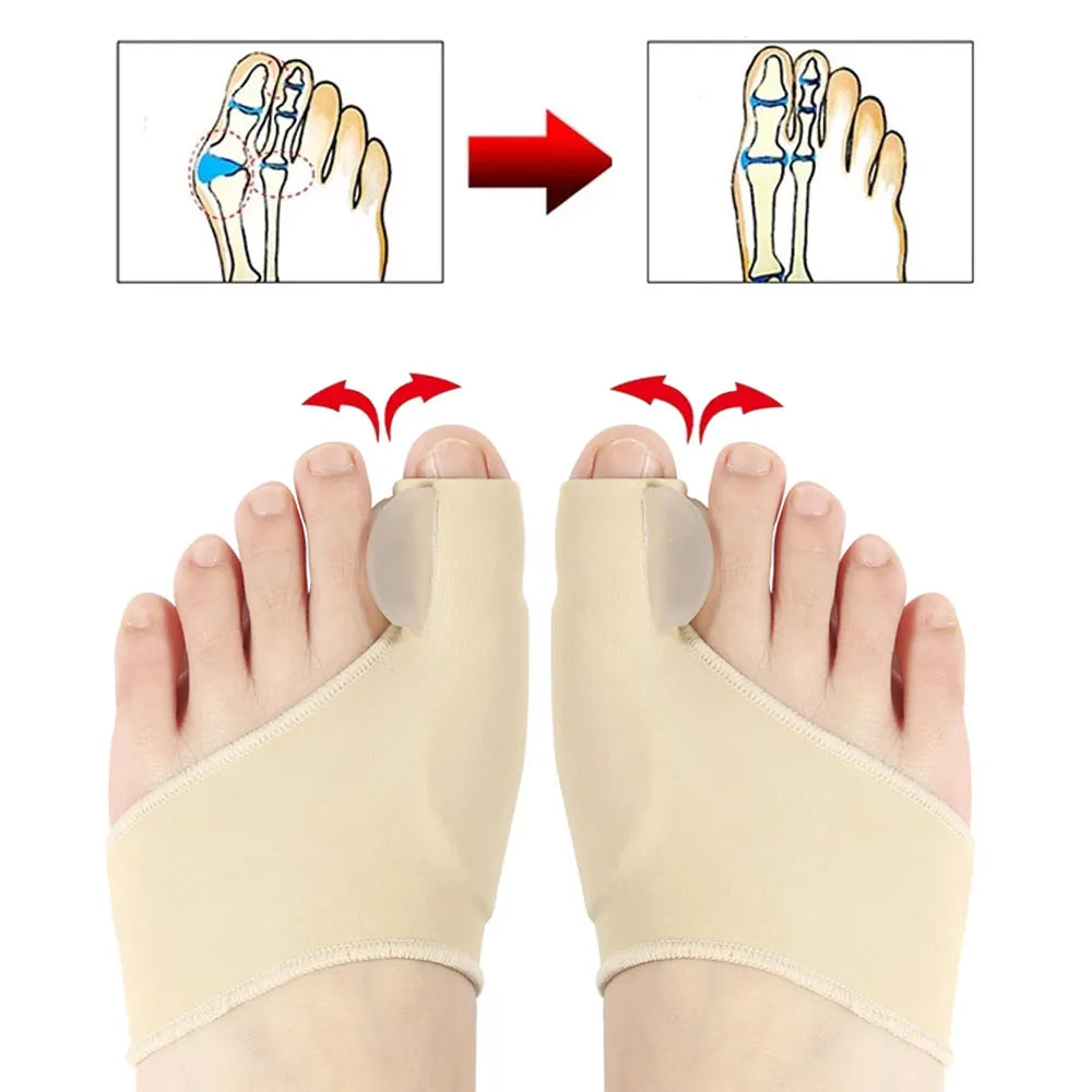 FootAlign Precision Correctors
